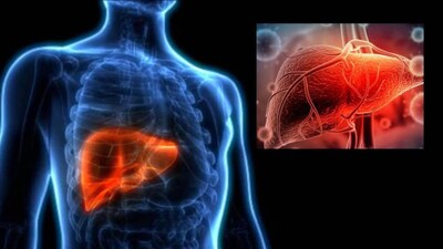 ভারতে, নন-অ্যালকোহলিক ফ্যাটি লিভার ডিজিজ বা এনএএফএলডি (NAFLD) এখন লিভারের অন্যতম সাধারণ একটি রোগ। ইন্ডিয়ান কাউন্সিল অফ মেডিকেল রিসার্চ–ন্যাশনাল ইনস্টিটিউট অফ নিউট্রিশন (ICMR-NIN) শহুরে প্রাপ্তবয়স্কদের মধ্যে ক্রমবর্ধমান স্থূলতা, ডায়াবেটিস এবং উচ্চ-চর্বিযুক্ত খাবারকে এর প্রধান কারণ হিসেবে চিহ্নিত করেছে।