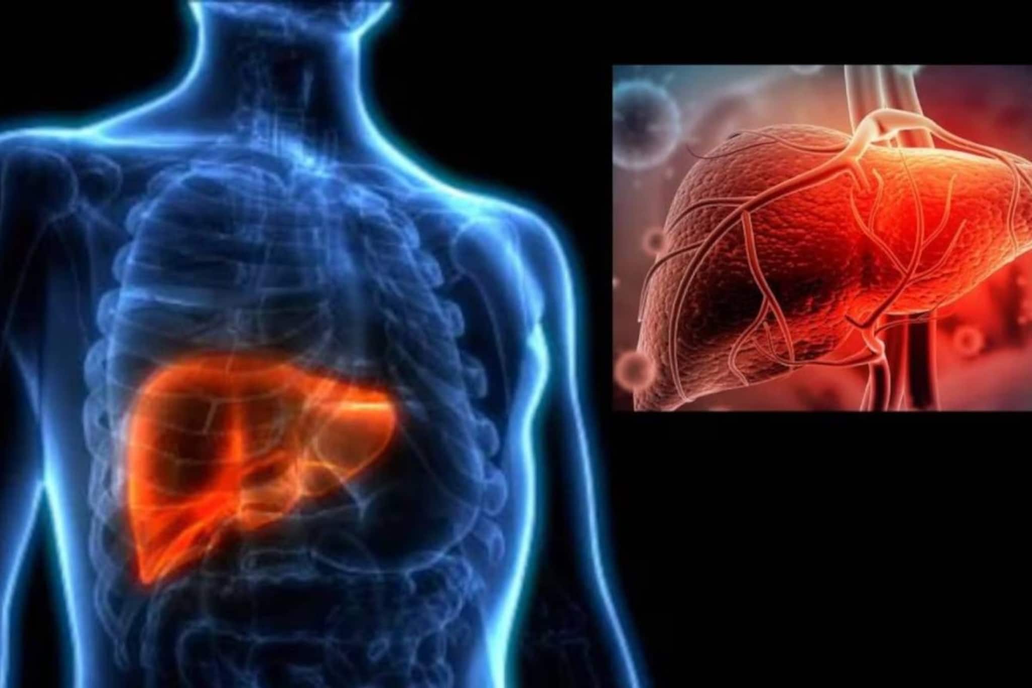 তেল-ঘি জবজবে খাবারেই নয়! অফিসের এই বদঅভ্যাসেও লিভারে জমতে পারে চর্বি! ফ্যাটি লিভারের অচেনা কারণগুলি জানুন