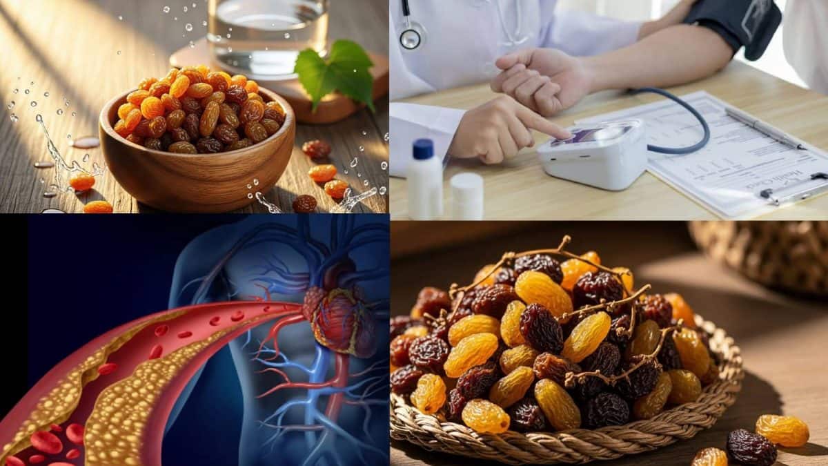 Raisins to cure Heart Disease & Blood Pressure: ১ মুঠো কিশমিশ এভাবে খেলেই আপনি নিশ্চিন্ত! আপনার কাছে আসবে না ব্লাড প্রেশার আর হার্টের রোগ! জব্দ অ্যানিমিয়াও