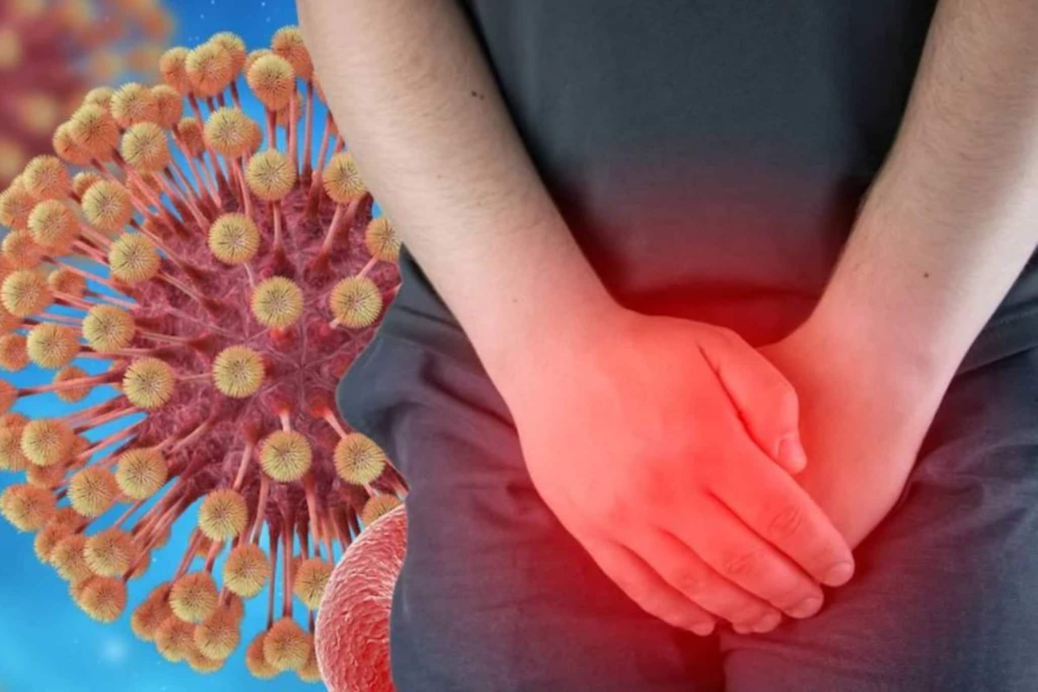 মুখ,ঠোঁট, চোখ, গোপনাঙ্গ ফোসকা-ফুসকুড়ি? হতে পারে এই ভয়ঙ্কর রোগ! জানুন লক্ষণ ও বাঁচার উপায়! মুখ,ঠোঁট, চোখ, গোপনাঙ্গ ফোসকা-ফুসকুড়ি? হতে পারে এই ভয়ঙ্কর রোগ! জানুন লক্ষণ ও বাঁচার উপায়!