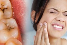 Tooth Pain Home Remedies: পথের ধারে জঙ্গলে বেড়ে ওঠা আগাছার গুণে পায়োরিয়া, দাঁতের ব্যথার বংশনাশ! পগারপার পেটের রোগ, অর্শ, চর্মরোগ, মুখের ঘা!