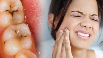 আগাছার গুণে পায়োরিয়া, দাঁতের ব্যথার বংশনাশ! পগারপার পেটের রোগ, অর্শ, চর্মরোগ, মুখের ঘা!