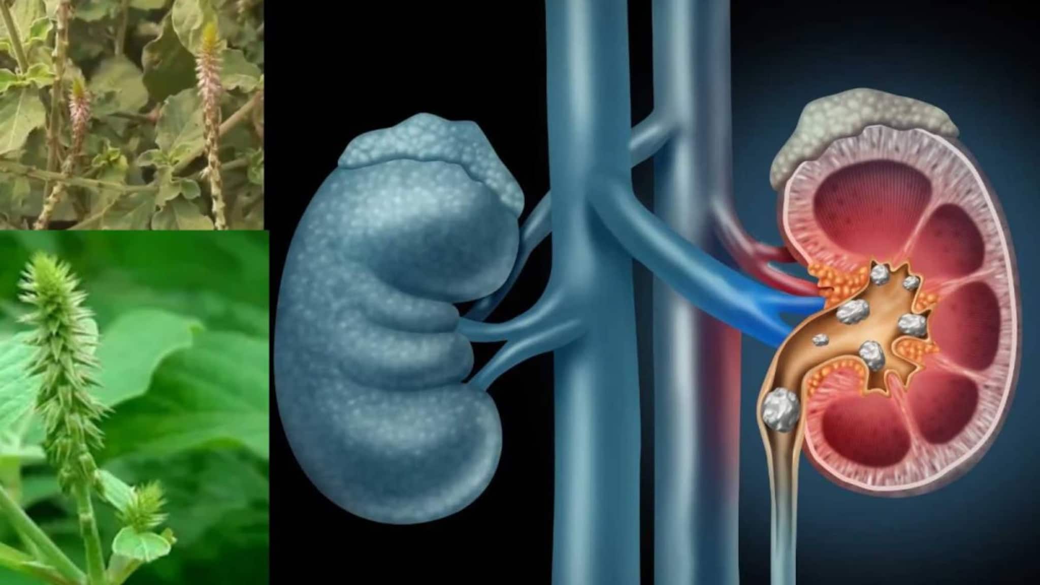 Kidney Stone & Piles: ওষুধ ছাড়াই গুঁডো় গুঁড়ো করে গলিয়ে দেবে কিডনির পাথর! ধুয়েমুছে সাফ অর্শ! এই বুনো গাছ দাঁতের রোগেও অমৃত!