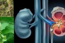 Kidney Stone & Piles: ওষুধ ছাড়াই গুঁডো় গুঁড়ো করে গলিয়ে দেবে কিডনির পাথর! ধুয়েমুছে সাফ অর্শ! এই বুনো গাছ দাঁতের রোগেও অমৃত!