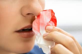 গরমে নাক দিয়ে রক্তপাত? সে সময় ভুলেও করবেন না ১ বিশেষ কাজ! গলায় প্রবাহিত হতে পারে রক্ত!