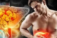 Fatty Liver: ২ ফল-১ সবজি-১ পাতার রসের কামাল! লিভার থেকে টেনে বার করে নোংরা চর্বি! মুক্তি ফ্যাটি লিভার থেকে