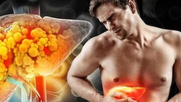 ২ ফল ১ সবজি ১ পাতার রসের জাদু! লিভার থেকে দূর করে নোংরা চর্বি! মুক্তি ফ্যাটি লিভার থেকে!