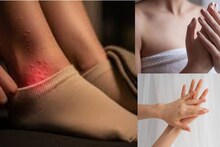 Palms & Feet Sweating: কয়েক ফোঁটা দিন হাত-পায়ে! মোজায় দুর্গন্ধের দিন শেষ! একটুও ঘাম হবে না যতই গরম পড়ুক