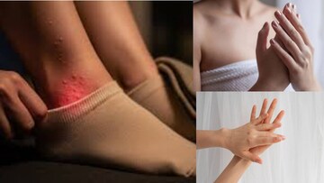 কয়েক ফোঁটা দিন হাত-পায়ে! মোজায় দুর্গন্ধের দিন শেষ! একটুও ঘাম হবে না যতই গরম পড়ুক