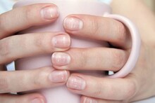 White Spots on Nails: আপনার নখে কি সাদা দাগ আছে? কোন বড় রোগের লক্ষণ? জটিল অসুখ বাসা বেধেছে শরীরে? জানুন