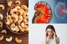 Cashewnut Side Effects: কিডনিতে পাথর, মাইগ্রেন...আর কোন কোন রোগে কাজুবাদাম বিপজ্জনক? জানুন কারা ভুলেও এটা দাঁতে কাটবেন না