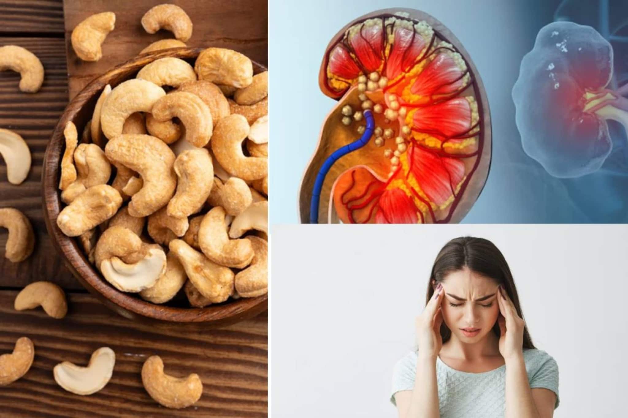 কিডনিতে পাথর, মাইগ্রেন...আর কোন কোন রোগে কাজুবাদাম বিপজ্জনক? জানুন কারা ভুলেও এটা দাঁতে কাটবেন না কিডনিতে পাথর, মাইগ্রেন...আর কোন কোন রোগে কাজুবাদাম বিপজ্জনক? জানুন কারা ভুলেও এটা দাঁতে কাটবেন না