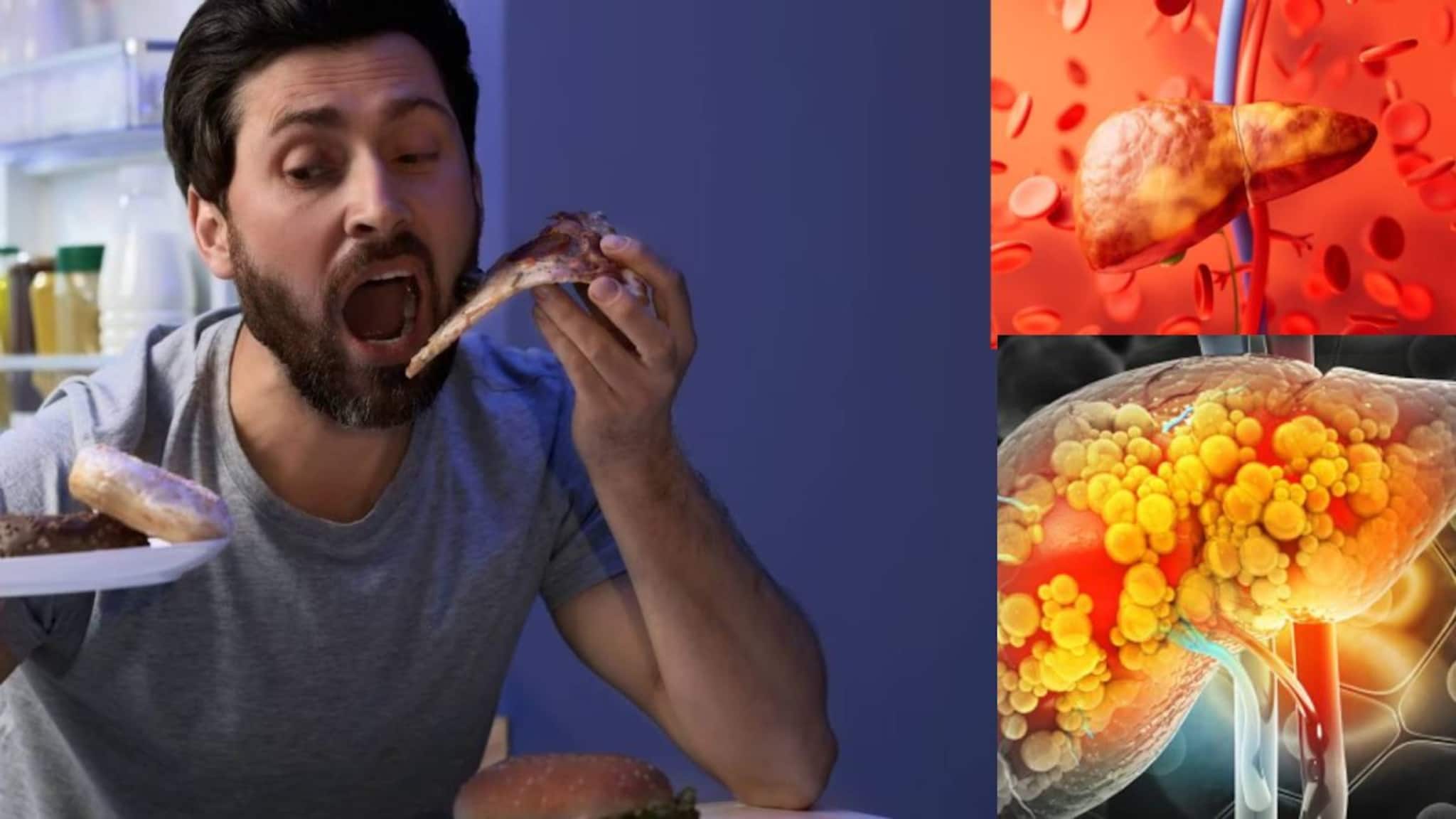 Food to stop Fatty Liver: কফি, বাদাম, মুসুর ডাল...৭ খাবারে নোংরামুক্ত লিভার! ফ্যাটি লিভারের যম ঘরোয়া খাবারগুলিকে চিনুন