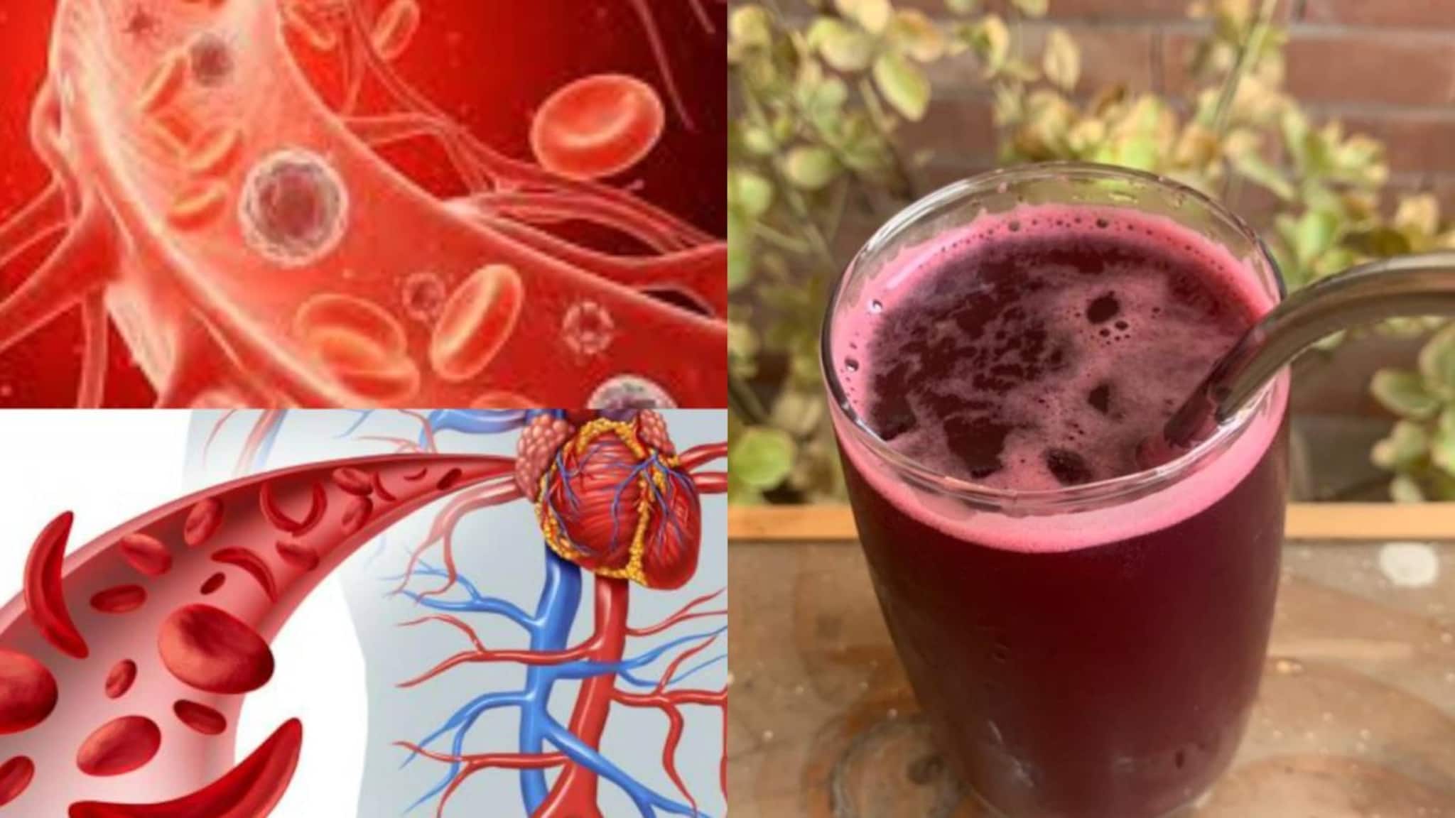 Anemia Cure Juice: ১ গ্লাস ‘লাল’ রসেই শুদ্ধ রক্ত! বাড়বে হিমোগ্লোবিন! অ্যানিমিয়া সারাতে মহৌষধ ২ সবজির রস!