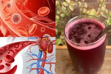 Anemia Cure Juice: ১ গ্লাস ‘লাল’ রসেই শুদ্ধ রক্ত! বাড়বে হিমোগ্লোবিন! অ্যানিমিয়া সারাতে মহৌষধ ২ সবজির রস!