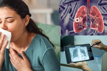 TB Symptoms: সাধারণ উপসর্গেই লুকিয়ে রাজরোগ যক্ষ্মা! এখনই চিনে নিন লক্ষণগুলি, বাঁচুন ভয়ঙ্কর ছোঁয়াচে অসুখের থাবা থেকে
