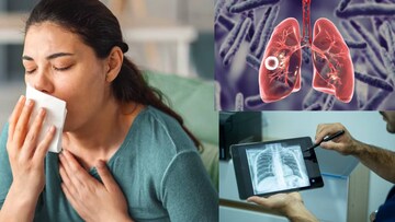 সাধারণ উপসর্গেই লুকিয়ে রাজরোগ যক্ষ্মা! এখনই চিনে নিন লক্ষণগুলি, বাঁচুন ভয়ঙ্কর ছোঁয়াচে অসুখের থাবা থেকে 