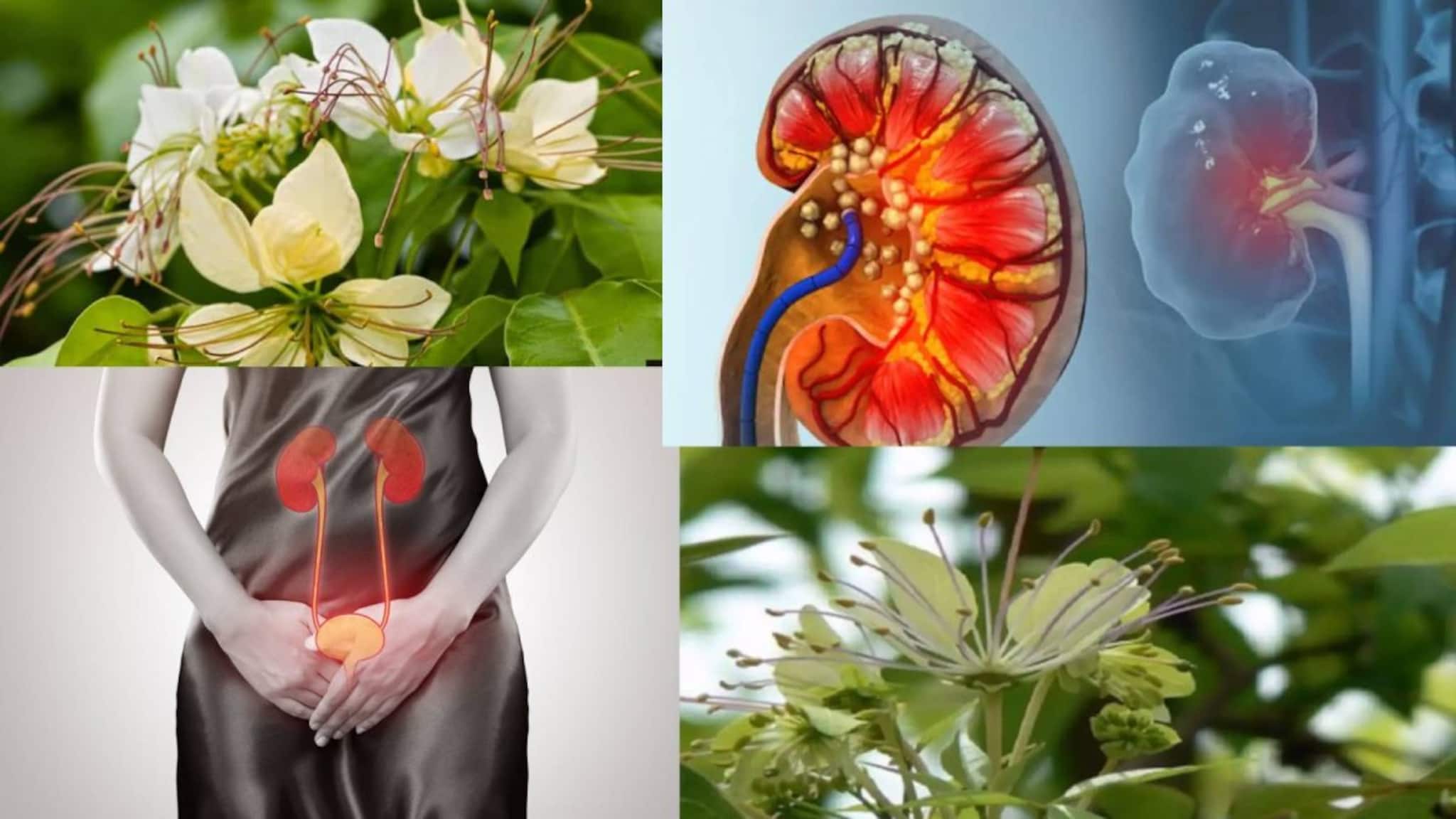 UTI & Kidney Stone: ‘সুপারহিরো’ আগাছা! সারাবে UTI-এর জ্বালা যন্ত্রণা! গলাবে কিডনিতে জমা পাথর! ছুটি অ্যাসিডিটি-বদহজমেরও!