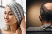 White Hair & Hair Fall Tips: ভাতের সঙ্গে একটু হলেও খান এই ২ ফল, ২ ডাল! অকালে পেকে সাদা হবে না চুল! পড়বে না টাক! গ্যারান্টি-টিপস এক্সপার্টের!