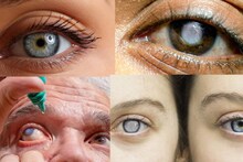 Eye Disease Symptoms: উইপোকার মতো কুরে কুরে খায় চোখ! দৃষ্টি হারিয়ে নেমে আসে অন্ধকার! জানুন ভয়ঙ্কর রোগের লক্ষণ ও নিরাময়