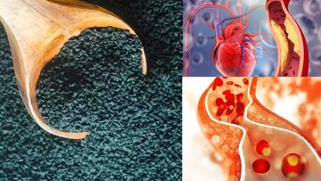 রান্নাঘরের চেনা কালো মশলা রোজ জাস্ট ১ চামচ...বদ কোলেস্টেরল কমিয়ে রুখে দেয় হার্টের রোগ