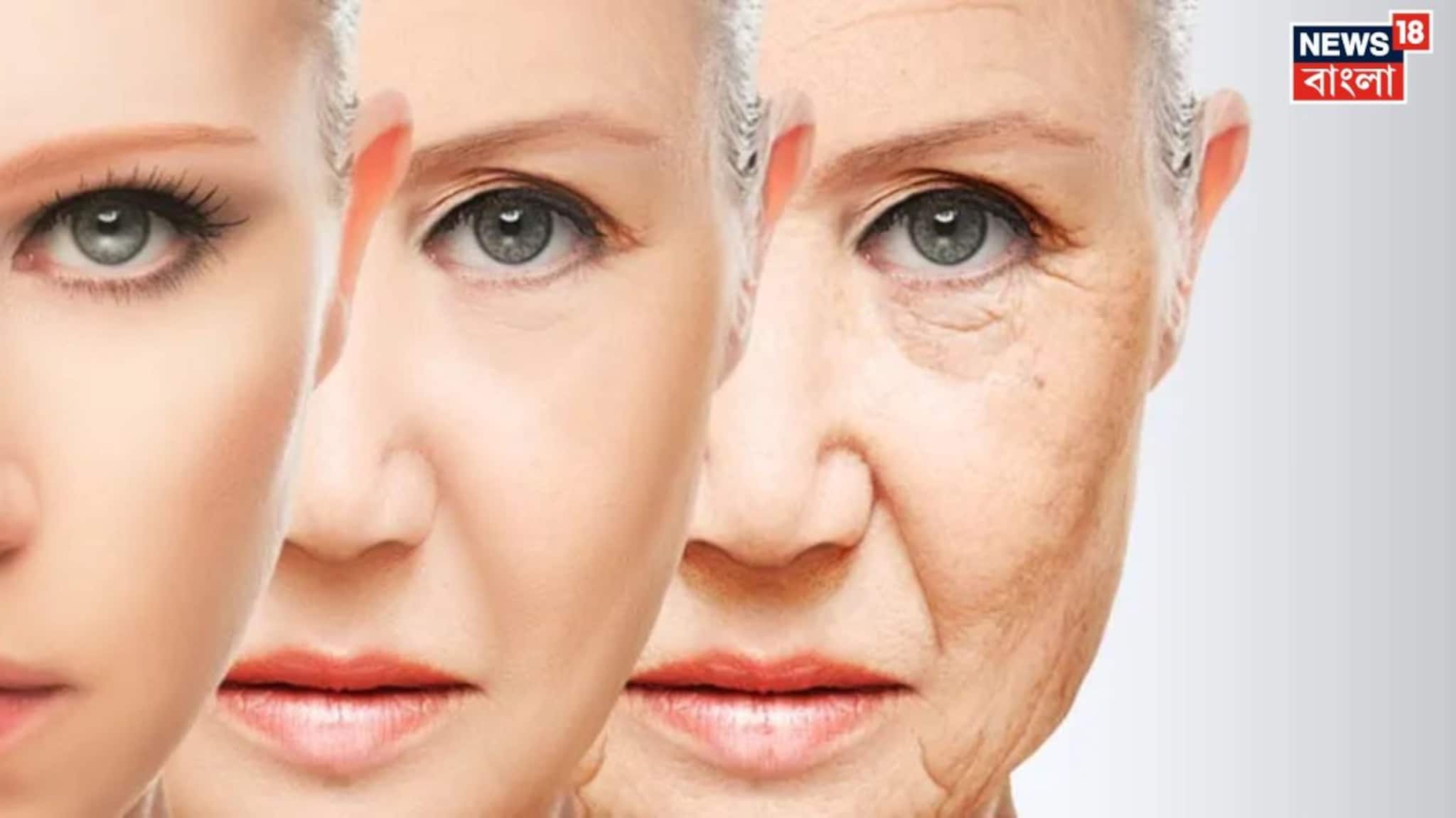 Ozempic Face: ওজেম্পিক ফেস কি হুড়মুড়িয়ে ওজন কমায়? টাইপ ২ ডায়াবেটিস থাকলে খাওয়ার আগে জানুন