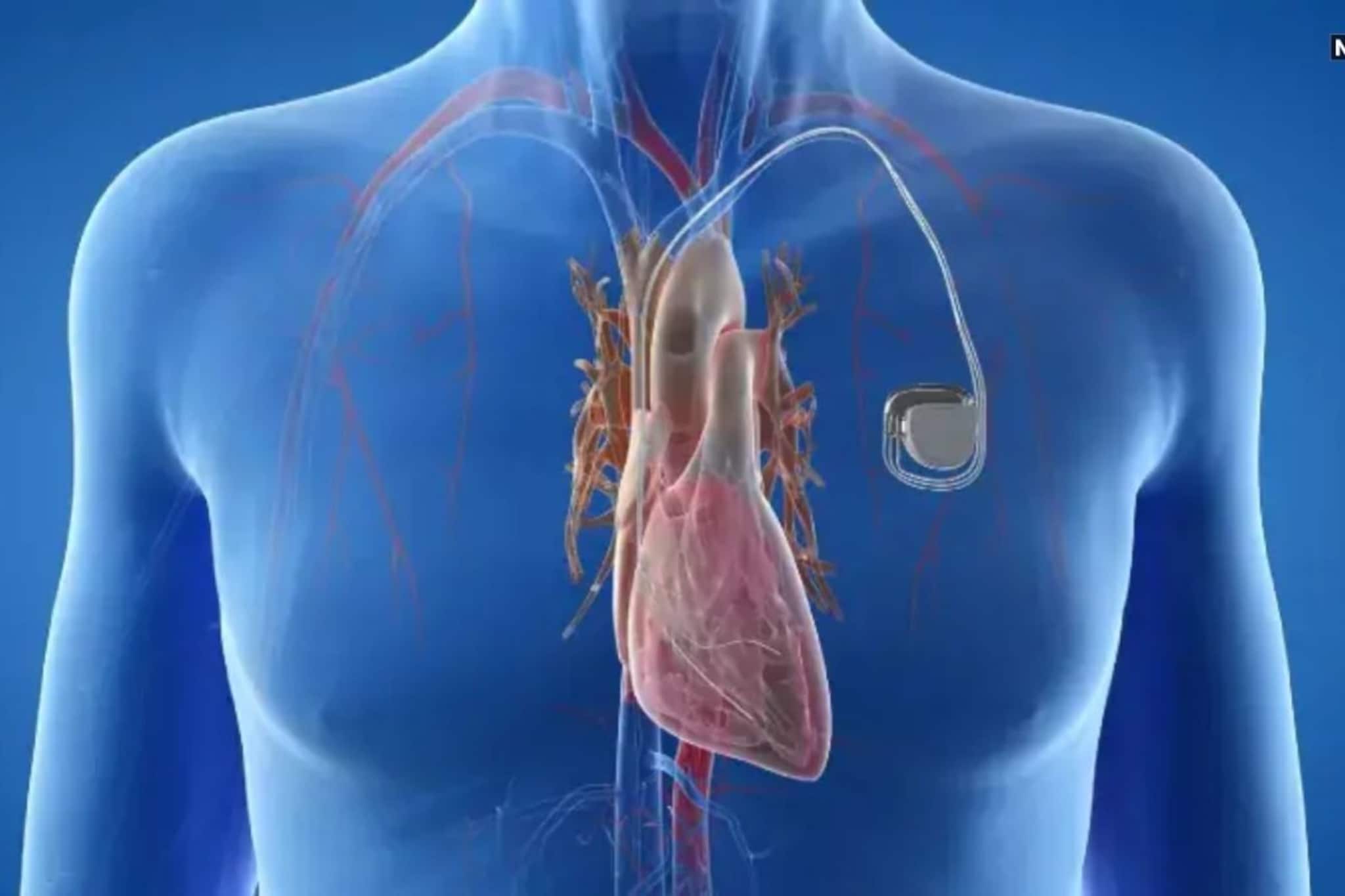  হৃদরোগ জয় করে ৪ দিনেই পরীক্ষার হলে! পেসমেকার বসিয়ে নতুন জীবন পেল কোচবিহারের কিশোর