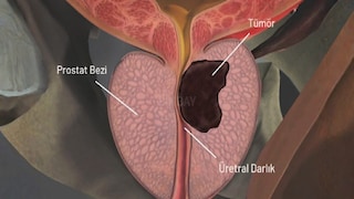 প্রস্রাবের রং হলদে হচ্ছে দেখে এড়িয়ে যাবেন না প্রস্রাবের রং হলদে হচ্ছে দেখে এড়িয়ে যাবেন না