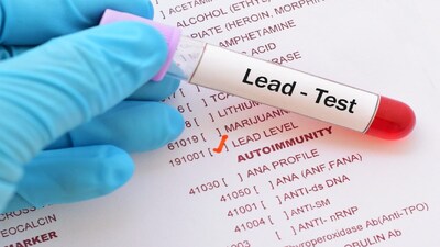 Lead found in everyday vegetables