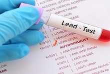 Lead in vegetables: লাউ, বেগুনের মতো রোজের ১১ সবজিতে 'ভয়', মিলছে গাদাগাদা বিষাক্ত সীসা,শরীরে ঢুকে বিকল করছে লিভার-কিডনি,পঙ্গু করছে ব্রেন