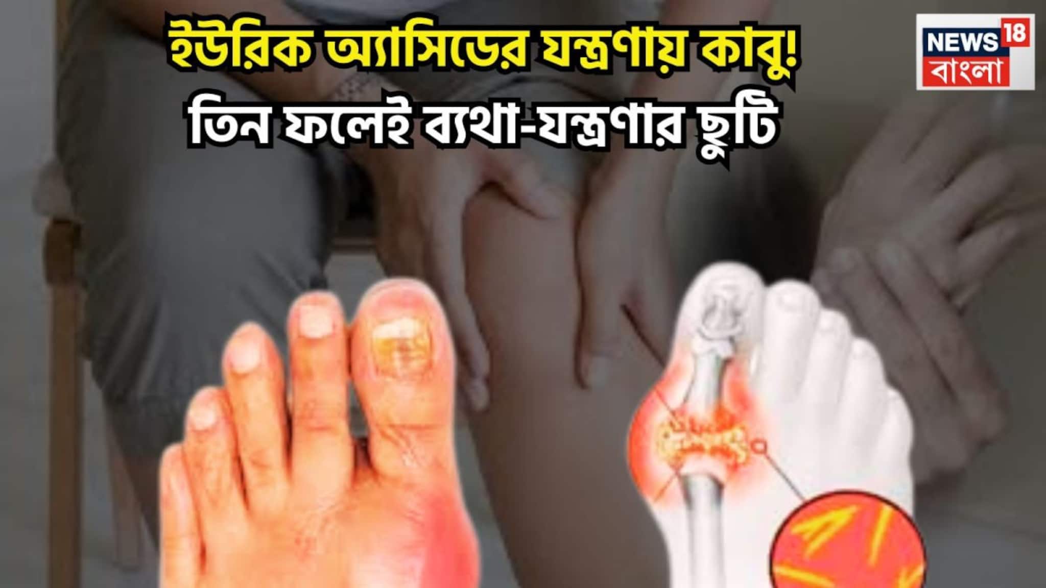 High Uric Acid Control Tips: ইউরিক ব্যথা-যন্ত্রণা থেকে মুক্তি! তিনটি ফলই ছেঁকে বের করবে, এক্কেবারে জব্দ, শরীর মন এক্কেবারে টানটান