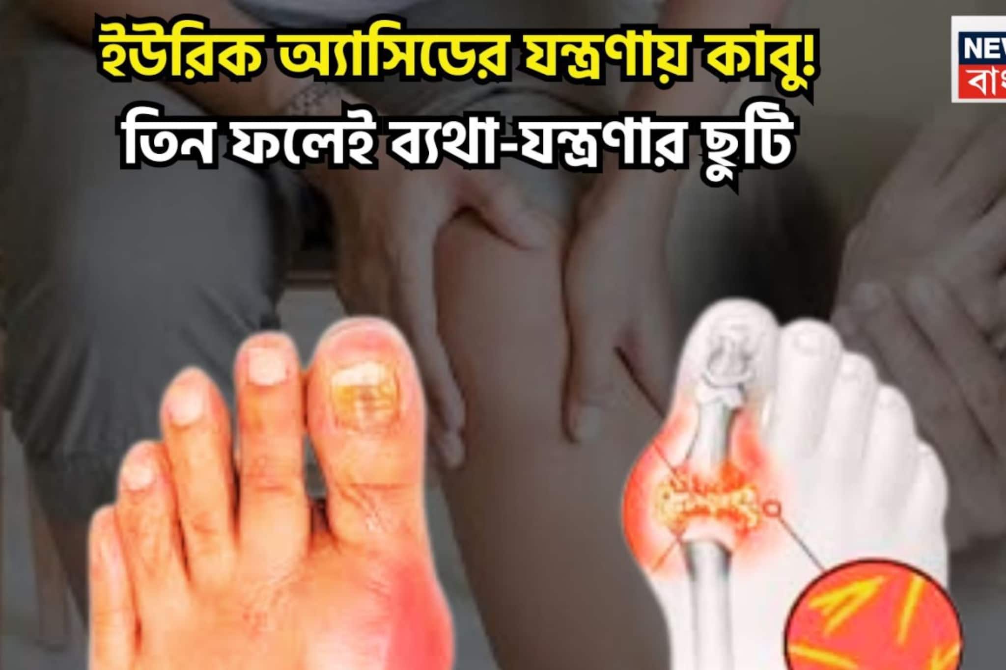 High Uric Acid Control Tips: ইউরিক ব্যথা-যন্ত্রণা থেকে মুক্তি! তিনটি ফলই ছেঁকে বের করবে, এক্কেবারে জব্দ, শরীর মন এক্কেবারে টানটান