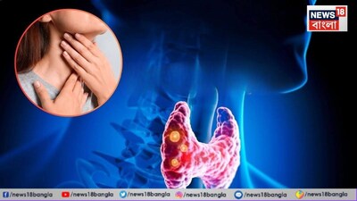 থাইরয়েড