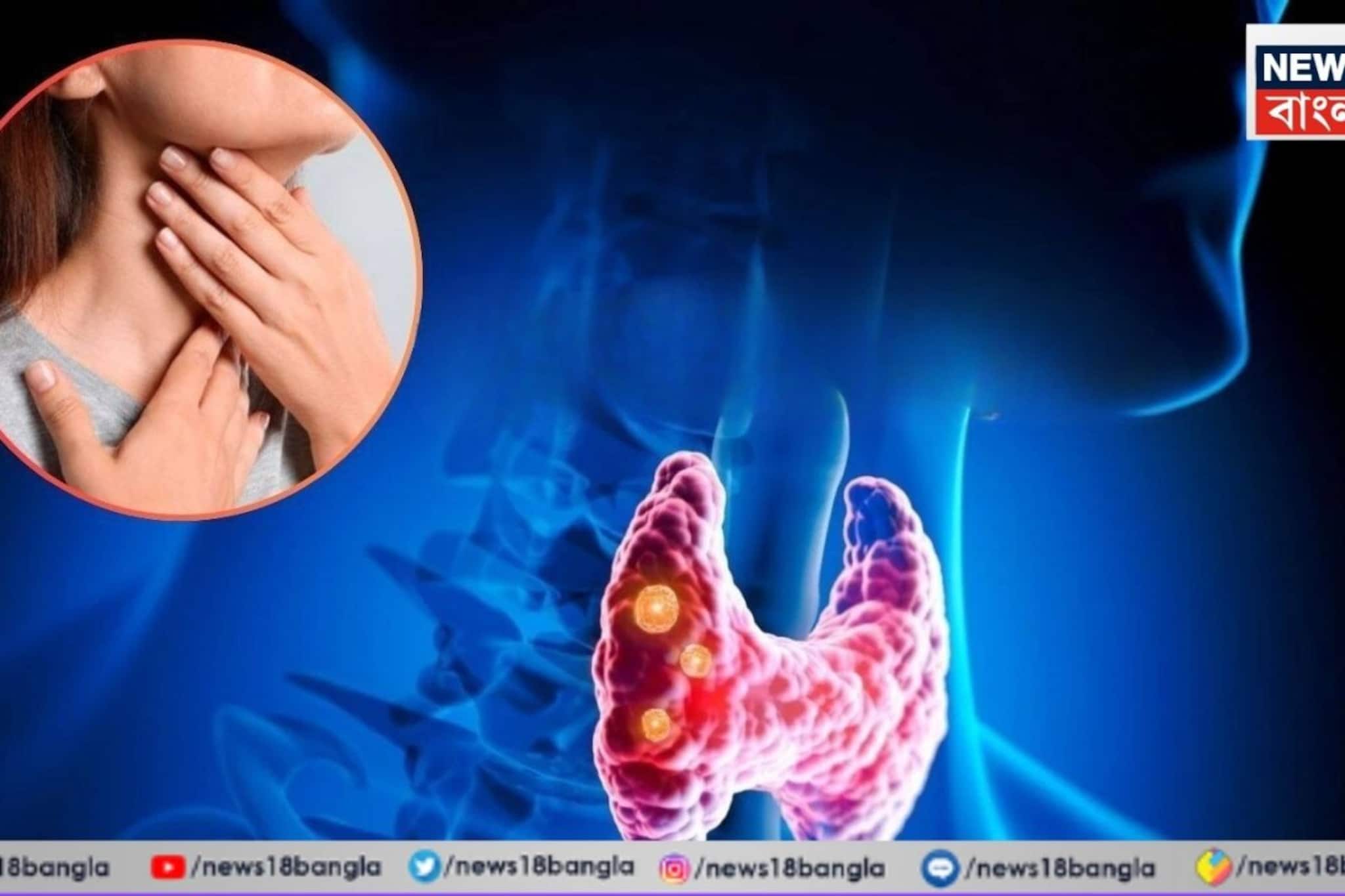 থাইরয়েড থাকলে ১০০ হাত দূরে থাকুন রোজের চেনা 'এই' খাবার, ফল, সবজি থেকে!নচেৎ শরীর ভেঙে দেবে