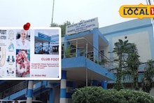 West Bardhaman News: বিনামূল্যে লক্ষাধিক টাকার চিকিৎসা! ক্লাবফুট নিরাময়ে আসানসোলের হাসপাতালের সাফল্য, ভিন জেলা থেকেও ছুটে আসছে রোগীরা