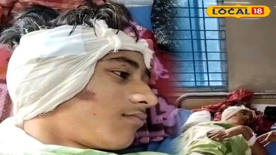 দুর্ঘটনায় যুবকের কাটা কান জোড়া লাগিয়ে নজির গড়ল বনগাঁ মহকুমা হাসপাতাল