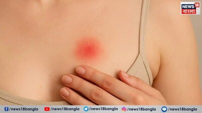 স্তন ক্যানসার বুঝবেন কীভাবে?