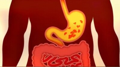 Effect Of Alchohol On Body