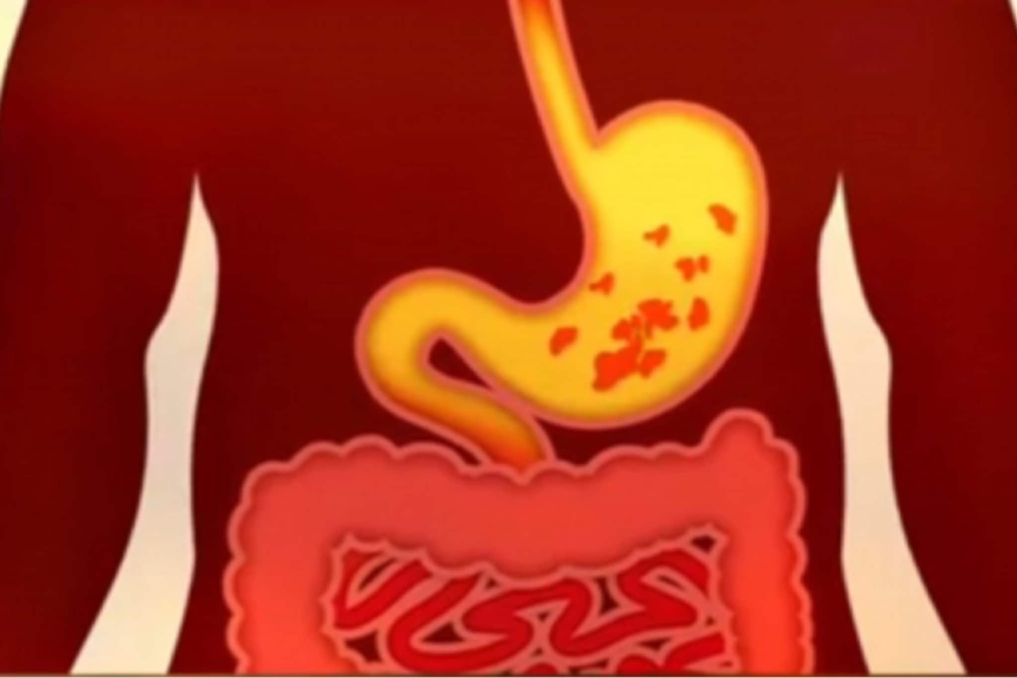 মদ্যপানের মিনিট খানেকের মধ্যেই শরীরে যা যা শুরু হয়, চিকিৎসক যা বললেন, শুনলে চমকে উঠবেন মদ্যপানের মিনিট খানেকের মধ্যেই শরীরে যা যা শুরু হয়, চিকিৎসক যা বললেন, শুনলে চমকে উঠবেন