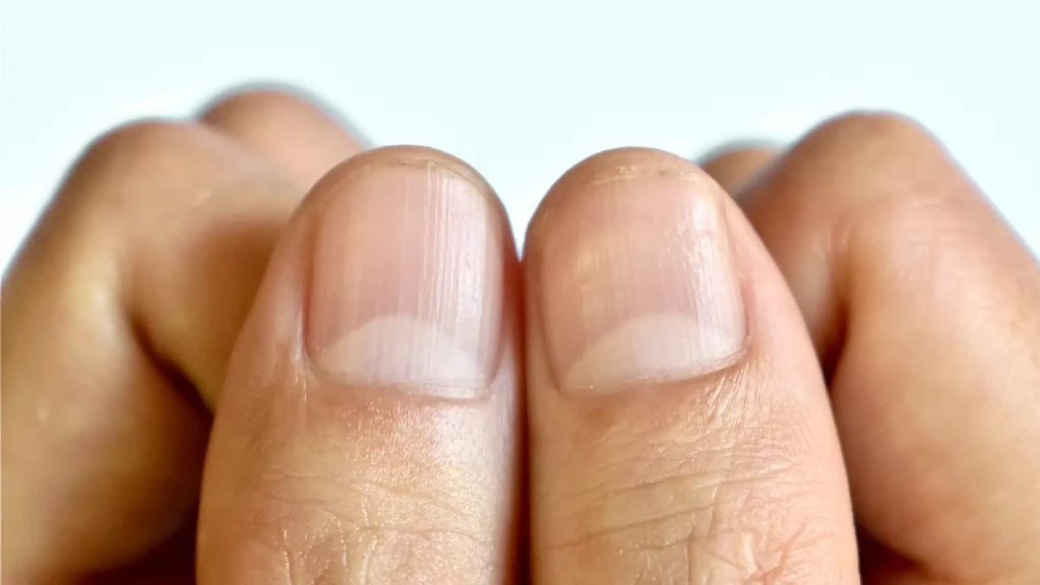 Half Moon Mark On Nail: নখের উপর অর্ধচন্দ্রাকার চিহ্ন আছে? এ কীসের ইঙ্গিত বলুন তো? জানলে চমকে উঠবেন