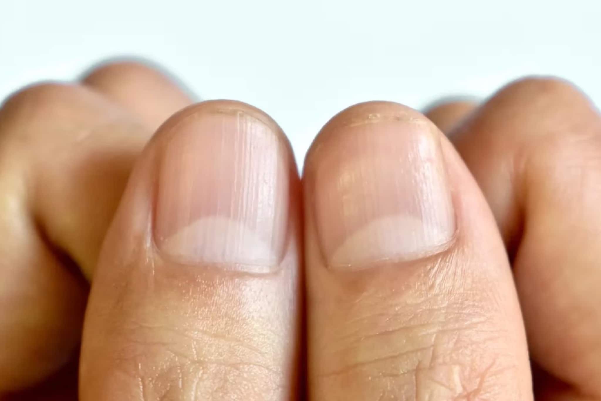 নখের উপর অর্ধচন্দ্রাকার চিহ্ন আছে? এ কীসের ইঙ্গিত বলুন তো? জানলে চমকে উঠবেন নখের উপর অর্ধচন্দ্রাকার চিহ্ন আছে? এ কীসের ইঙ্গিত বলুন তো? জানলে চমকে উঠবেন