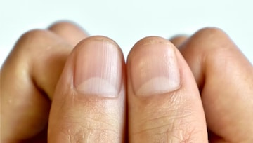 নখের উপর অর্ধচন্দ্রাকার চিহ্ন আছে? এ কীসের ইঙ্গিত বলুন তো? জানলে চমকে উঠবেন নখের উপর অর্ধচন্দ্রাকার চিহ্ন আছে? এ কীসের ইঙ্গিত বলুন তো? জানলে চমকে উঠবেন