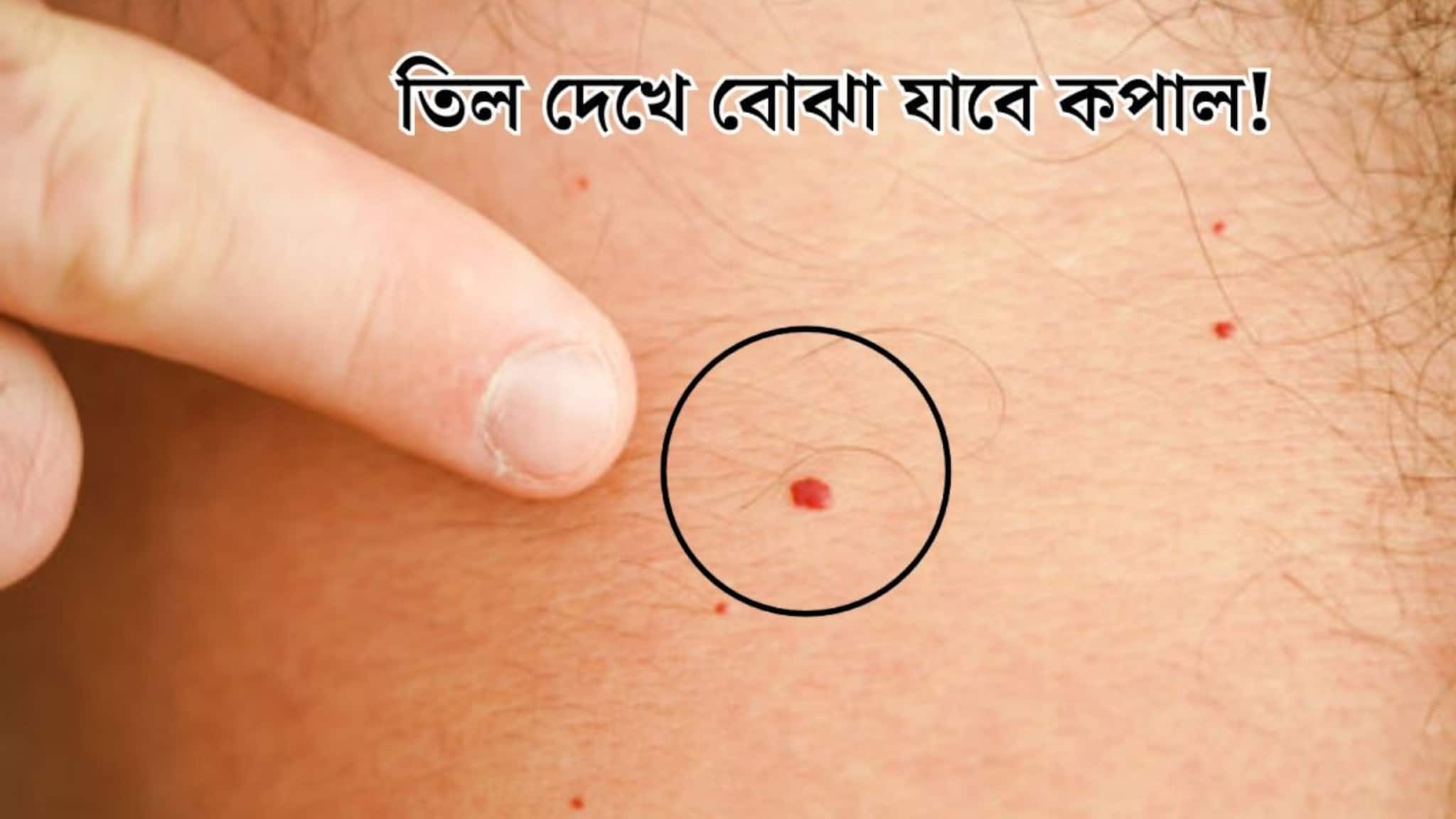Moles: কালো, লাল...তিলের রং দেখেই বোঝা যাবে কপাল! শরীরের এই জায়গায় লাল তিল থাকা মানেই ‘কোটিপতি’, জানুন তিলের রহস্য
