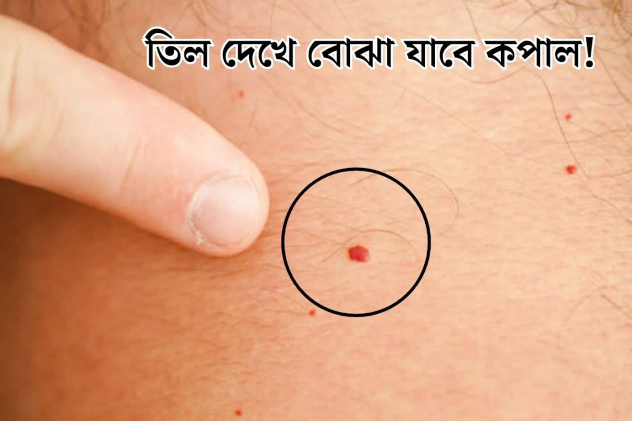 কালো, লাল...তিলের রং দেখেই বোঝা যাবে কপাল! শরীরের এই জায়গায় লাল তিল থাকা মানেই ‘কোটিপতি’