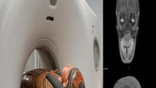 মমির সিটি স্ক্যান করতেই ধরা পড়ল চাঞ্চল্যকর তথ্য! মমির সিটি স্ক্যান করতেই ধরা পড়ল চাঞ্চল্যকর তথ্য!