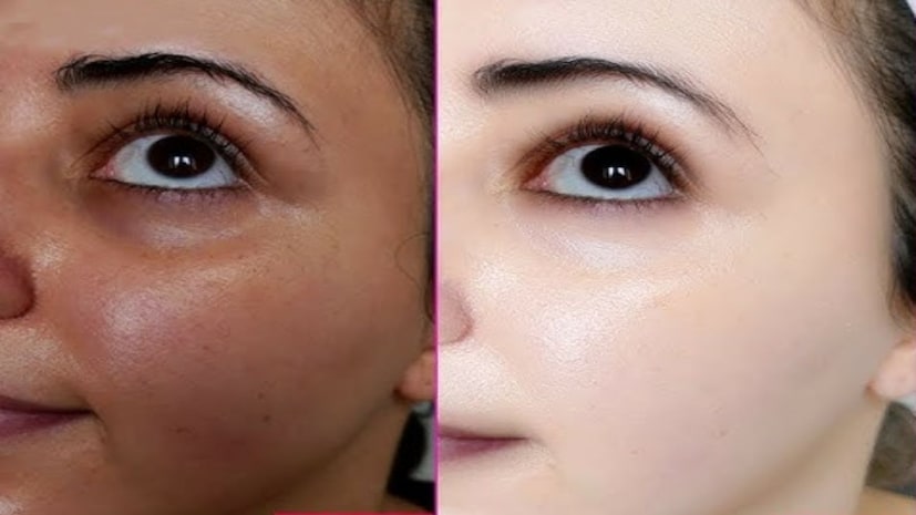 গরমকাল এসে গেল গুঁটি গুঁটি পায়ে। কিন্তু গরমে একদিকে যতই আম-কাঁঠাল খাওয়ার সুখ থাকুক না কেন এই গ্রীষ্মকালেই আপনার মুখ হয়ে যায় অমাবস্যার চাঁদ। ত্বক ফ্যাকাশে ও কালো হয়ে যাওয়ার ফলে ভয় বাড়তে থাকে। বার বার আয়নায় চোখ রাখলেই মন খারাপ হয়ে যায়। ট্যানের কালো পরত ক্রমশ পুরু হতে থাকে অজান্তেই। গরমকাল এসে গেল গুঁটি গুঁটি পায়ে। কিন্তু গরমে একদিকে যতই আম-কাঁঠাল খাওয়ার সুখ থাকুক না কেন এই গ্রীষ্মকালেই আপনার মুখ হয়ে যায় অমাবস্যার চাঁদ। ত্বক ফ্যাকাশে ও কালো হয়ে যাওয়ার ফলে ভয় বাড়তে থাকে। বার বার আয়নায় চোখ রাখলেই মন খারাপ হয়ে যায়। ট্যানের কালো পরত ক্রমশ পুরু হতে থাকে অজান্তেই।