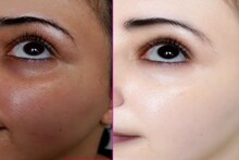 'ফুটফুটে' হয়ে যাবে মুখ...! গরমে রাতে ঘুমোনোর আগে এই 'সাদা' জিনিস মুখে মাখুন দু'বার, সকালেই দেখুন তফাৎ