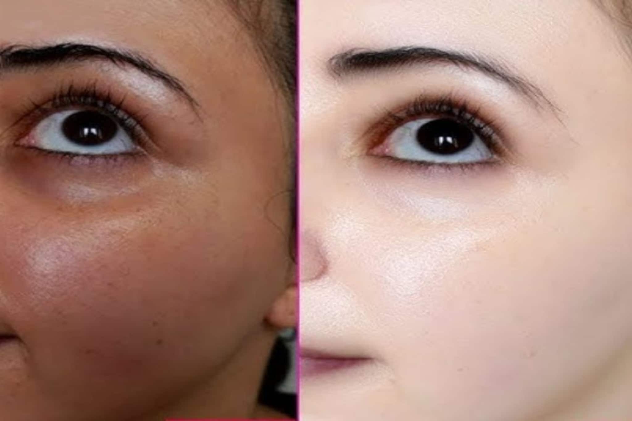 'ফুটফুটে' হয়ে যাবে মুখ...! গরমে রাতে ঘুমোনোর আগে এই 'সাদা' জিনিস মুখে মাখুন দু'বার, দেখুন তফাৎ