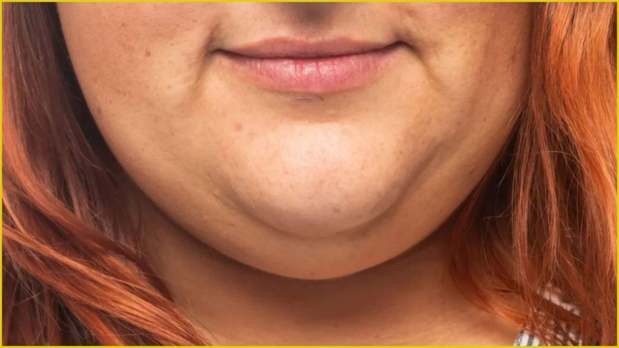 Double Chin: থুতনির নিচের বিরক্তিকর 'ডবল চিন'! অতিরিক্ত চর্বি বাড়িয়ে দেয় চেহারার বয়স! শুধু ১ মিনিটের টোটকায় কমবে ম্যাজিকের মতো