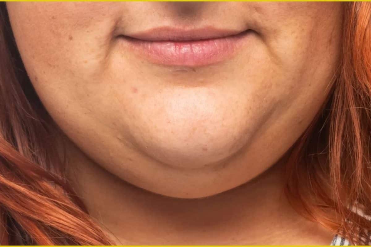 থুতনির নিচের বিরক্তিকর 'ডবল চিন'! অতিরিক্ত চর্বি বাড়িয়ে দেয় চেহারার বয়স! শুধু ১ মিনিটের টোটকা জানুন